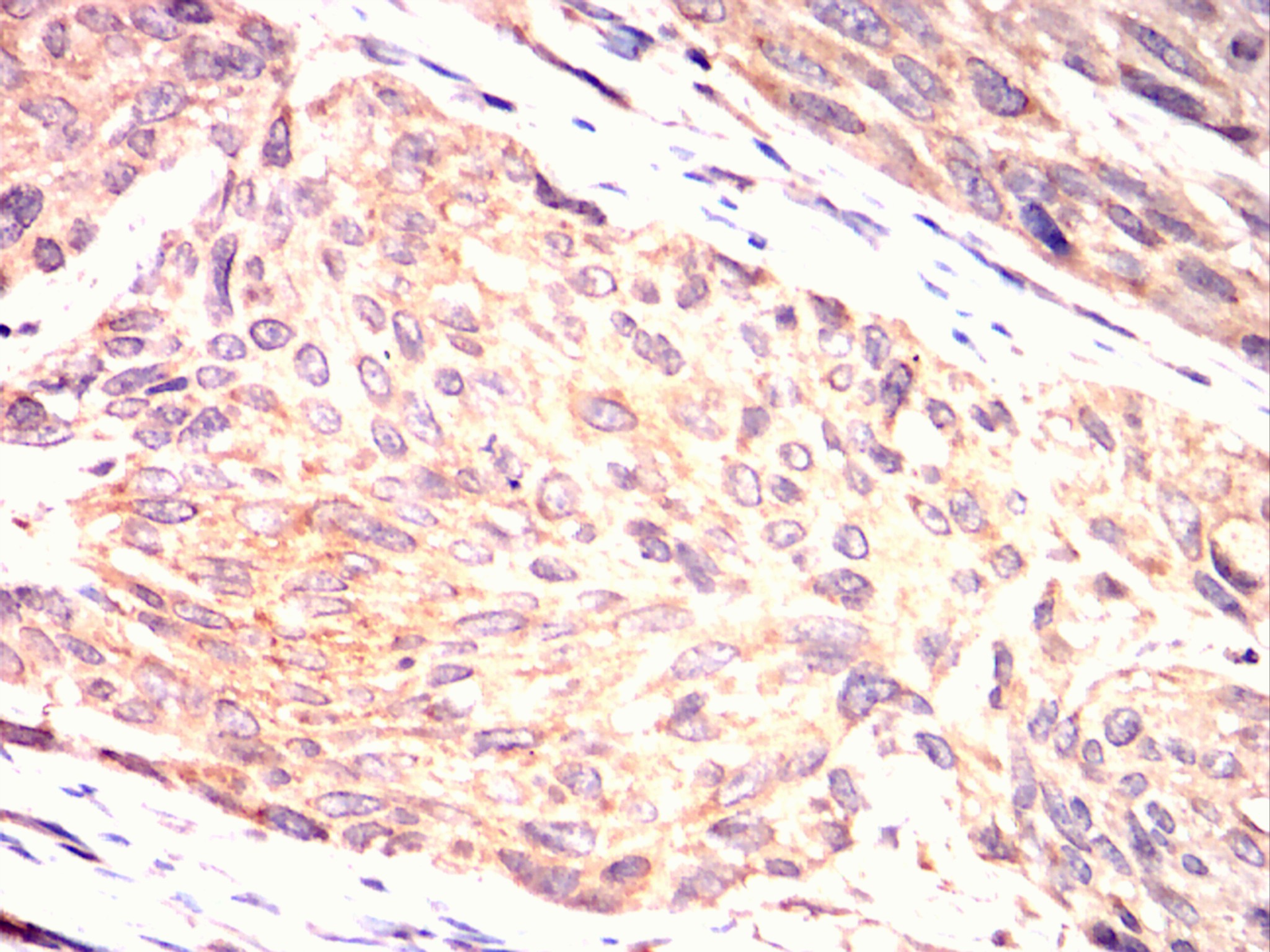		IHC